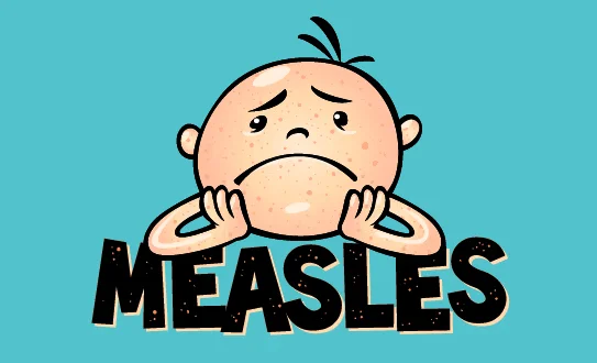 Cartoon of a sad child with measles rash on the face, resting their chin on their hands. The word MEASLES is written in large, bold letters below the child. The background is teal.