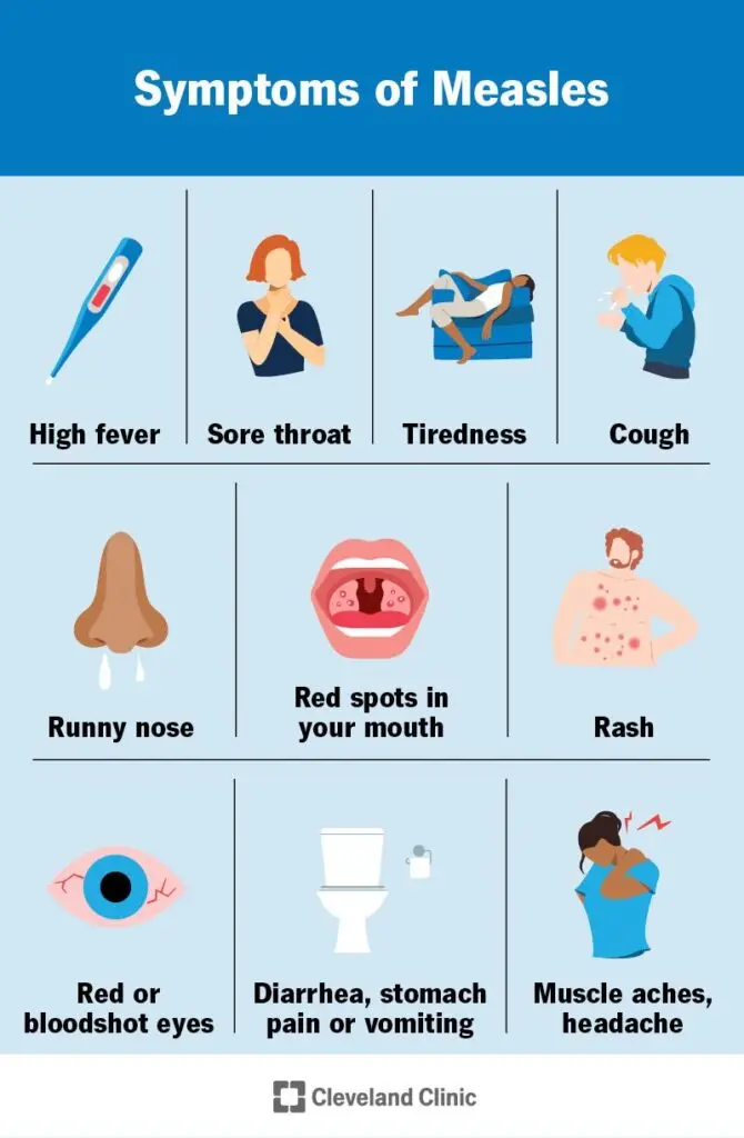 Infographic showing measles symptoms: high fever, sore throat, tiredness, cough, runny nose, red spots in mouth, rash, red or bloodshot eyes, diarrhea, stomach pain or vomiting, muscle aches, and headache.