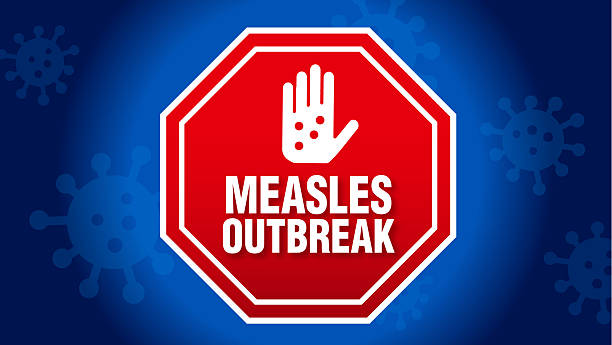 A red stop sign with a hand showing measles spots and the words Measles Outbreak in bold white text, set against a blue background with virus icons.